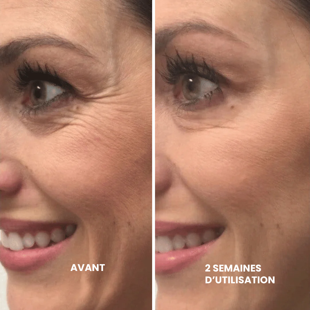 Eyverra™ L’alternative nouvelle génération au rétinol