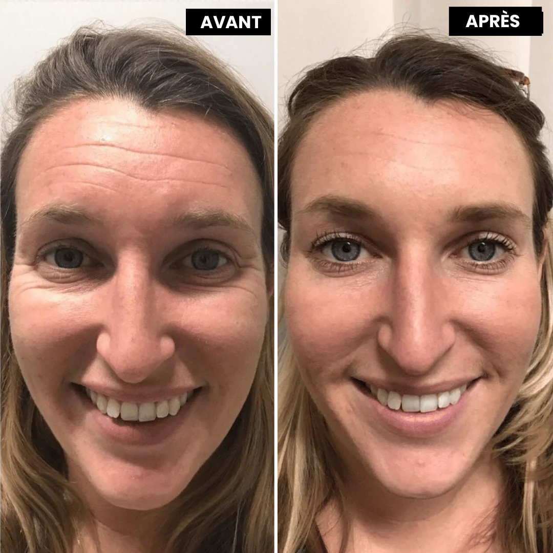 Eyverra™ L’alternative nouvelle génération au rétinol